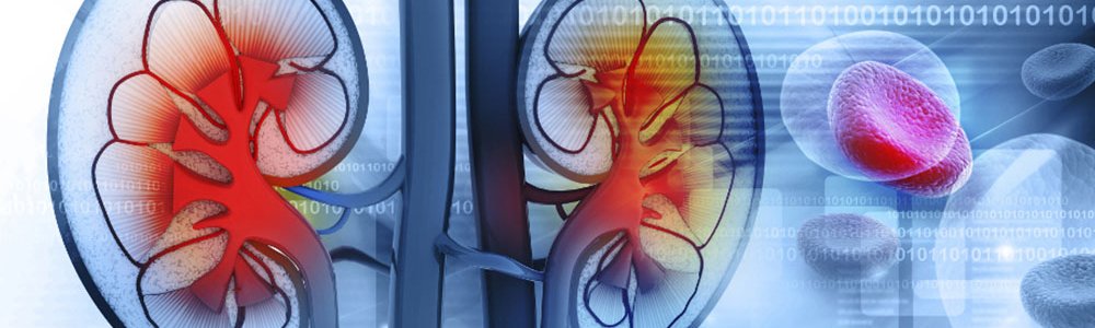 Dr. Mohan Singh Provide Best Kidney Failure Treatment in Delhi